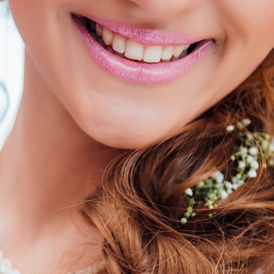 Seamless Smile for Your Big Day with Invisible Braces