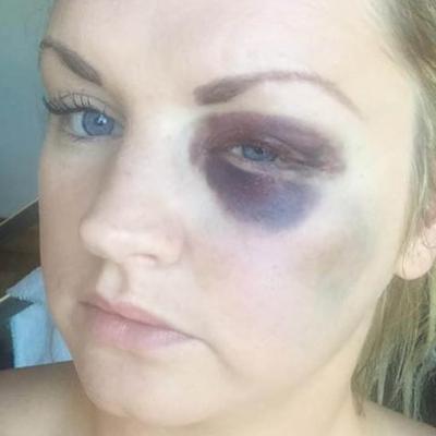 Groom Attacks and Breaks Bridesmaid&#039;s Face