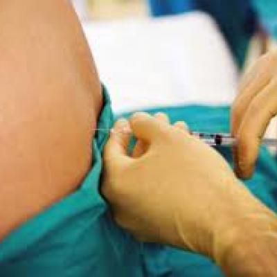 What You Need to Know About Epidural Anesthesia