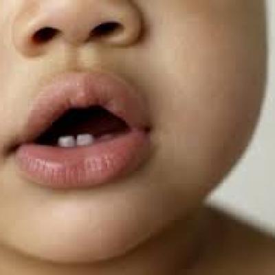 What You Need to Know About Teething