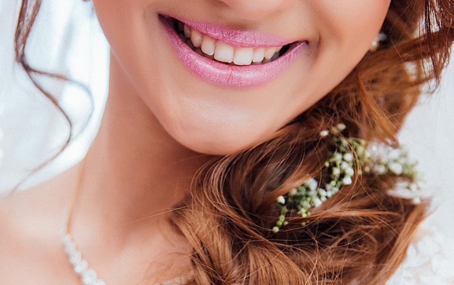 Seamless Smile For Your Big Day with Invisible Braces