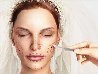 4 Tips for Brides Considering Plastic Surgery